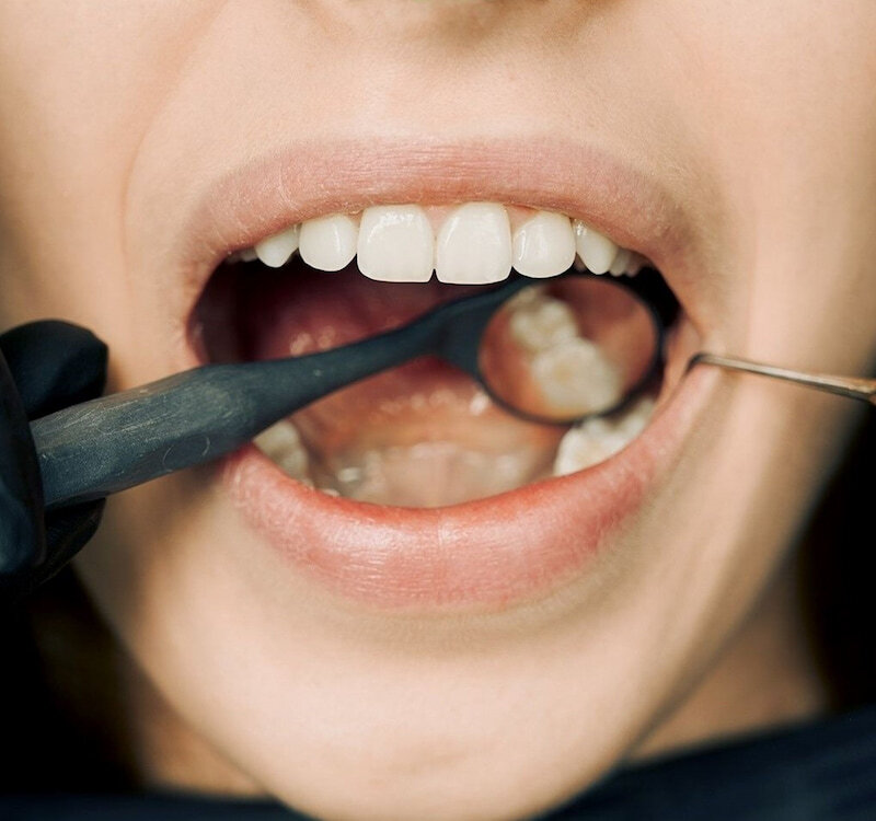 Mondzorg vergoeding tandarts